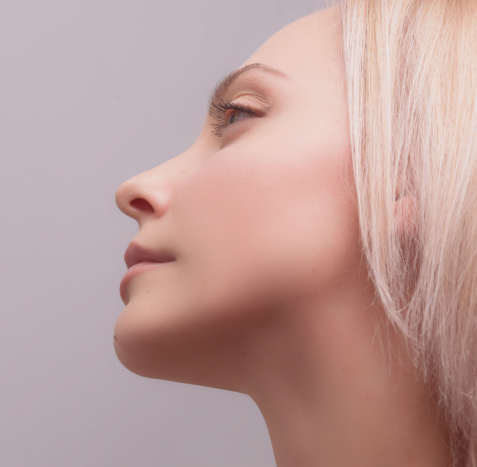 Paciente del Dr. Patricio Canepa antes de someterse a facelift endoscópico (deep endoscopic facelift) en Querétaro