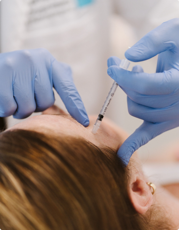Explicación visual del procedimiento de facelift endoscópico (deep endoscopic facelift) a cargo del Dr. Patricio Canepa
